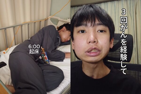 ▲▼男大生「嘴破3周沒好」確診舌癌！。（圖／IG／nakano1224_2000）