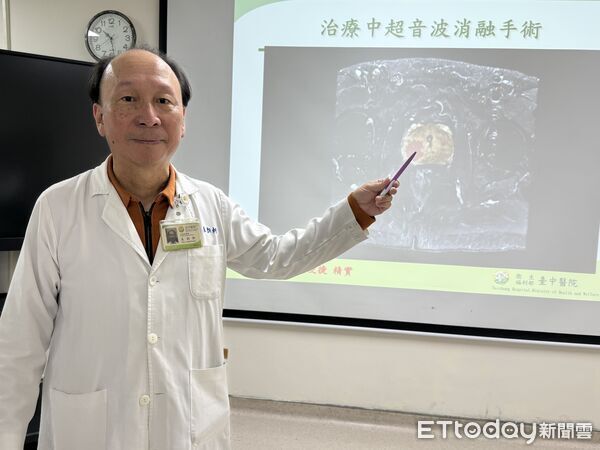 ▲泌尿科主任朱朗軒說明「海神刀」高強度聚焦超音波消融手術原理。（圖／記者游瓊華翻攝）