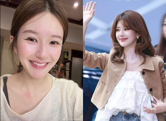 ▲趙露思蜂蜜過敏。（圖／翻攝自微博）