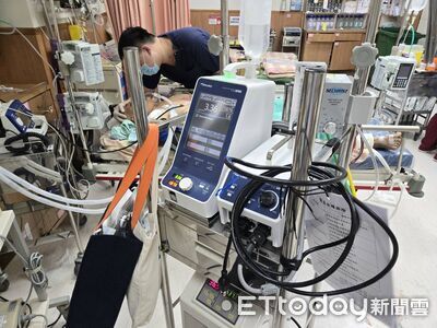 不只粽子分南北 醫曝葉克膜也有「南北症候群」:嚴重會致命