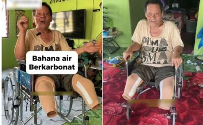 天天喝汽水還加煉乳！　馬國男截肢後悔了：再多存款也沒用