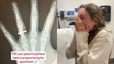 照X光驚見「無名指戴上鑽戒」　她當場感動哭了：我願意