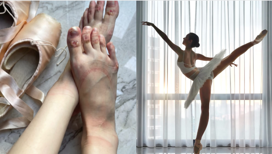 ▲▼李元玲腳傷。（圖／翻攝自Threads／cathrynli）