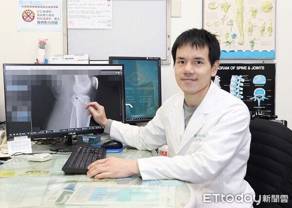 ▲電腦斷層影像顯示骨塊被韌帶拉起位置，屬典型外傷型態。（圖／記者游瓊華翻攝）