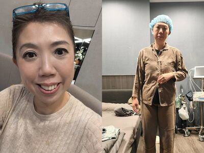 阿芳老師開刀！蔡季芳突PO手術服照震驚網　吐心聲「一夜無眠」