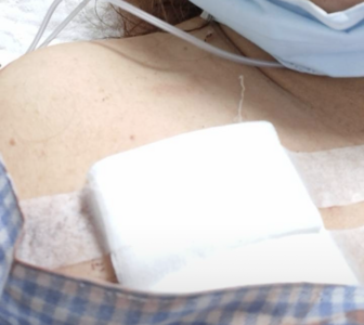 女保全遭8年男友持刀砍頭！兇殘犯案原因曝　她拒接電話險喪命