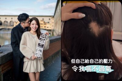港模結婚5年懷雙胞胎！求子壓力大到「鬼剃頭」　產檢見兩寶淚崩