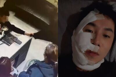 網紅「一生叔叔」燙髮糾紛遭噴辣椒水!滿臉紅腫慘況曝光