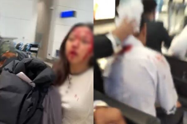 ▲杜拜機場多名員工受傷。（圖／翻攝自X）