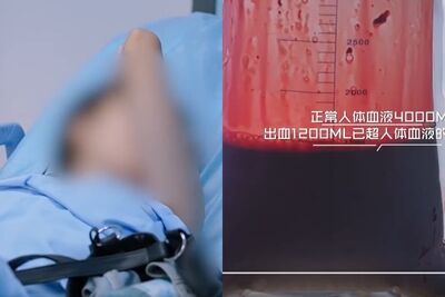 出血1200ml！　陸情侶激烈房事後…女友「黃體破裂險喪命」