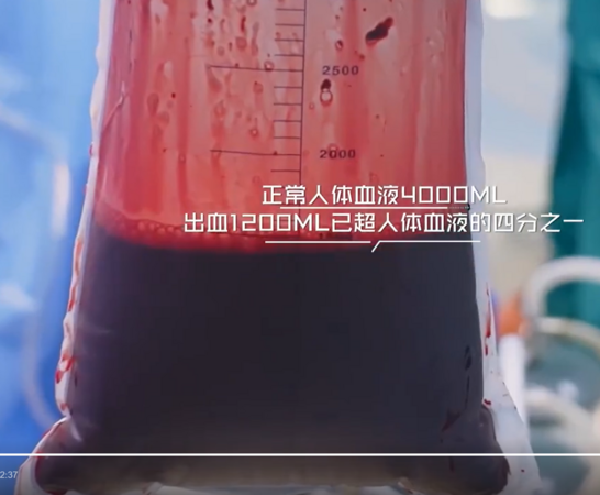 ▲▼陸情侶同房後女友黃體破裂險喪命。（圖／翻攝自微博）