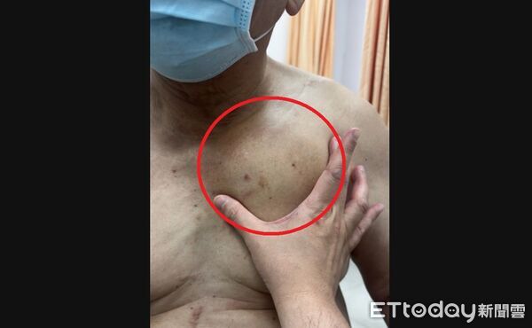 ▲血液腫瘤科,台中醫院,江佳駿。（圖／記者游瓊華攝）