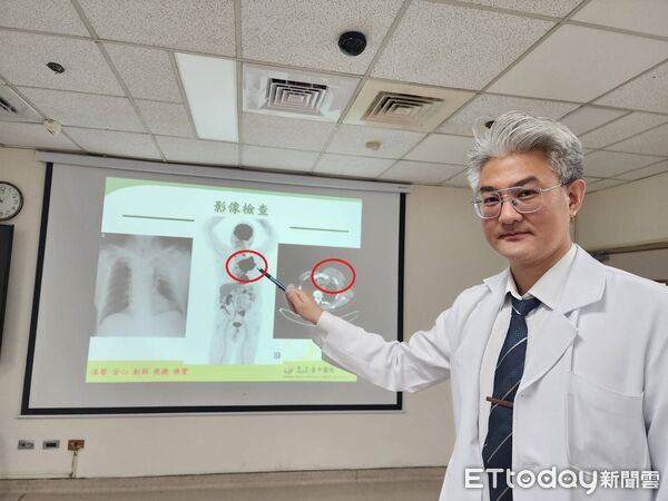 ▲血液腫瘤科,台中醫院,江佳駿。（圖／記者游瓊華攝）