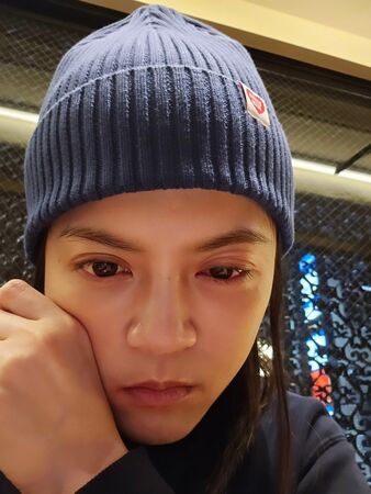 ▲葉欣眉大意弄傷自己眼睛。（圖／翻攝臉書）