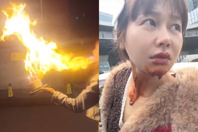 火舌吞臉！　陸甜美演員仿拍爆紅生日噴火蛋糕…慘遭「毀容」