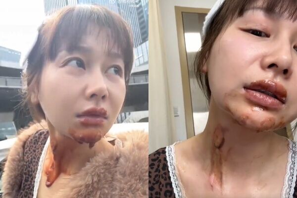 ▲▼陸甜美演員仿拍生日噴火蛋糕慘遭「毀容」。（圖／翻攝自微博）