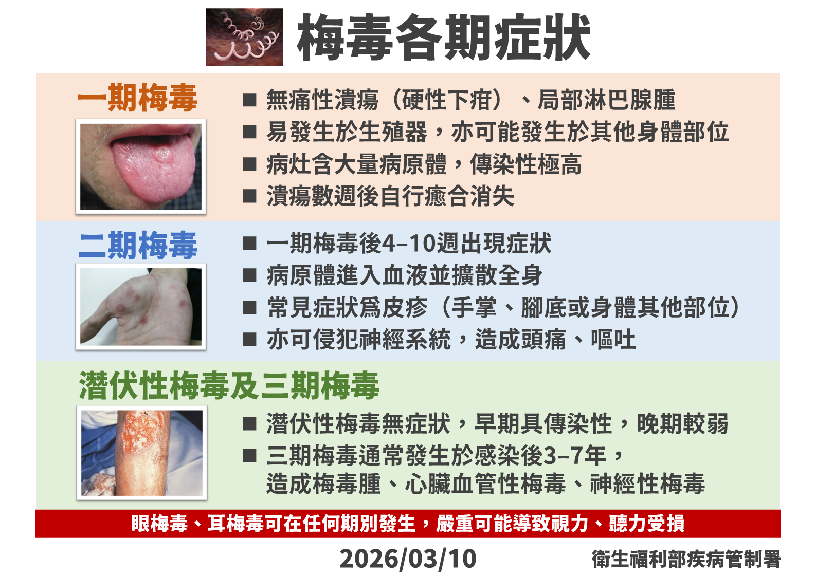 ▲▼三期梅毒症狀。（圖／疾管署提供）