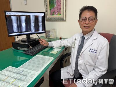 吃止痛藥苦撐「退化性關節炎」惡化　婦人雙膝換人工關節