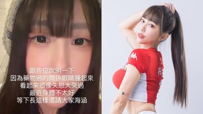 啦啦隊長藥物過敏「眼睛腫起來」　曬近距離自拍：像失戀