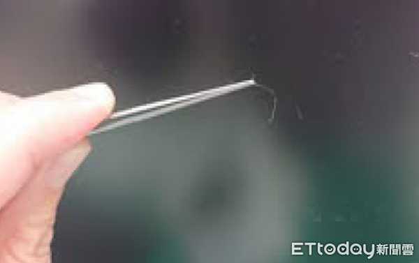 ▲▼    止血帶症候群         。（圖／許丁元醫師提供）