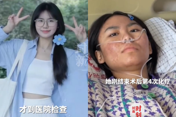 ▲李雅平患上大腸癌晚期。（圖／翻攝自微博）