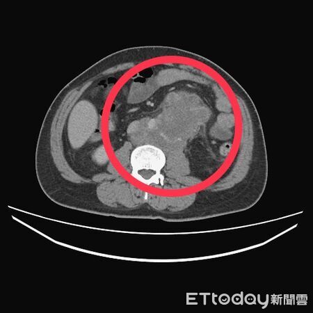 ▲台中醫院 血液腫瘤科。（圖／醫師江佳駿提供）
