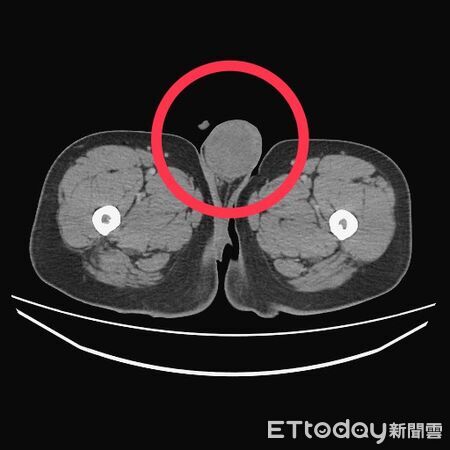 ▲台中醫院 血液腫瘤科。（圖／醫師江佳駿提供）