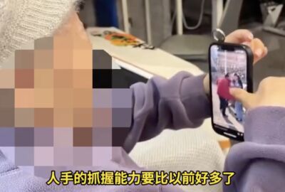 陸「腦機接口」技術進入臨床應用　癱瘓女受試一年「可以用手機」