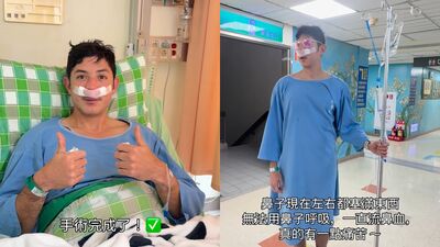 田舞陽自揭隱疾「急動2手術」　術後鼻血狂流：真的痛苦