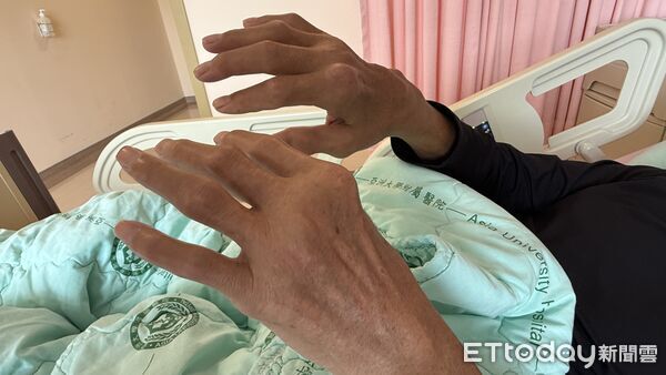 ▲亞大附醫,黃仁廷,骨折創傷科。（圖／亞大附醫提供）