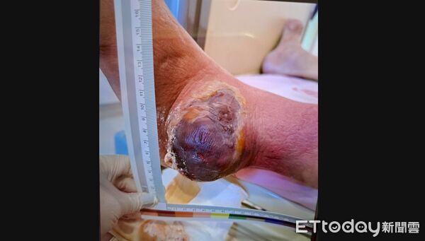 ▲亞大附醫,黃仁廷,骨折創傷科。（圖／亞大附醫提供）