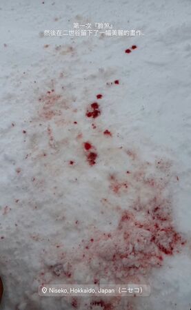 ▲黃薇渟在北海道滑雪出意外。（圖／翻攝自黃薇渟IG）