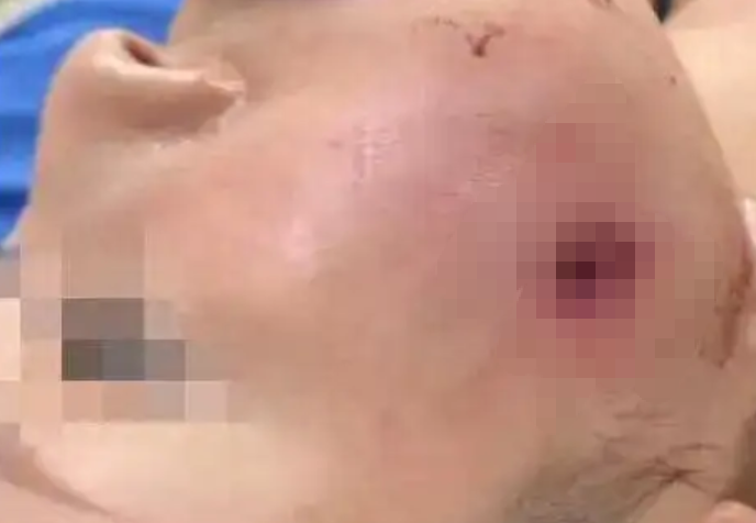 普吉島射擊場走火真相! 傷者家屬怒「員工玩私槍」穿臉子彈卡舌