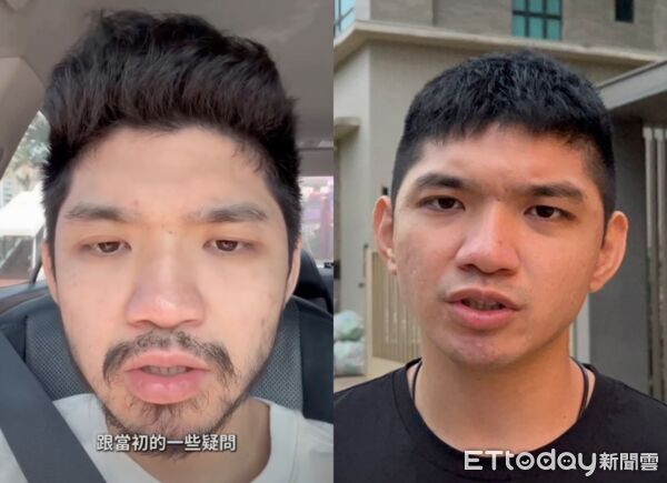 晚安小雞返台「人老了10歲」 醫揭高壓監禁身心影響 | ETtoday生活新聞 | ETtoday新聞雲