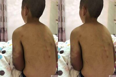 14歲陸少年被逼輟學3年遭虐死　親戚嘆：長年失禁穿紙尿褲