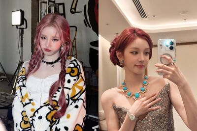 宋雨琦撞傷頭暫停活動！「持續頭痛」冒嚴重後遺症　證實遭強制靜養