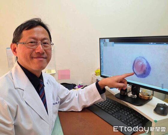 ▲▼以為是痘痘！14歲弟「肚皮詭凸一顆」迅速變大　醫驚：是肉癌。（圖／大千綜合醫院提供）