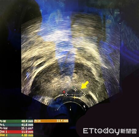 ▲▼             。（圖／中港澄清醫院提供）