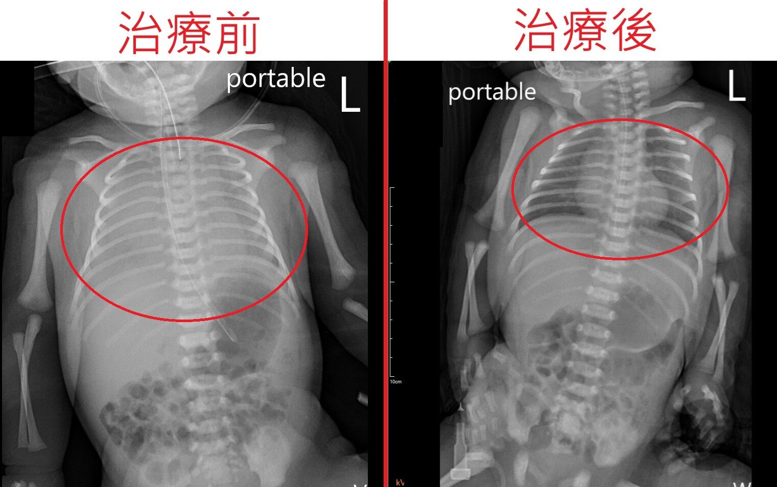 ▲男嬰出生「只哭兩聲就不動了&hellip;」爸嚇傻　醫揭奪命元凶。（圖／公關提供）