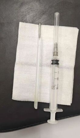 ▲▼陸男12歲吞體溫計　32歲「消化不順」才想起。（圖／翻攝微博）