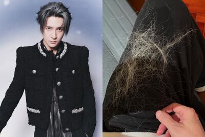 薛之謙漂金髮慘變鬼剃頭！　頭皮冒水泡「全是斷髮」：撐1周沒洗頭