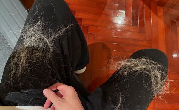 ▲▼薛之謙漂金髮慘變鬼剃頭！頭皮冒水泡：撐1周沒洗頭。（圖／翻攝自Instagram／xuezhiqian）