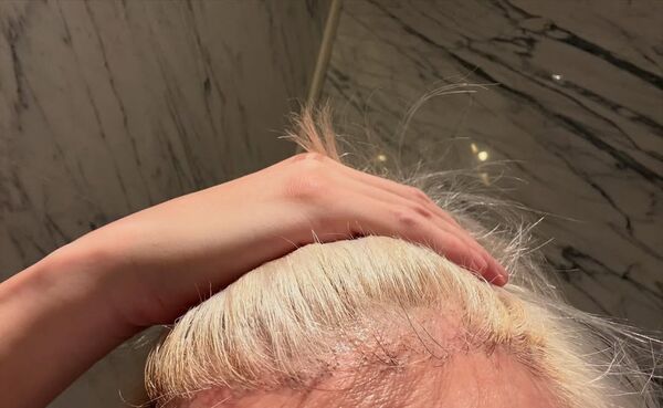 ▲▼薛之謙漂金髮慘變鬼剃頭！頭皮冒水泡：撐1周沒洗頭。（圖／翻攝自Instagram／xuezhiqian）