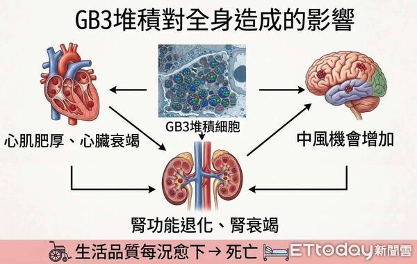 ▲東港安泰醫院確診屏東首例罕見疾病「法布瑞氏症」。（圖／東港安泰醫院提供）