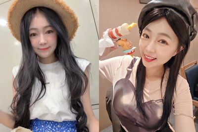 丫頭38歲生日爆血！　「頭摔破洞」釘5針曬照：給自己一個震撼教育