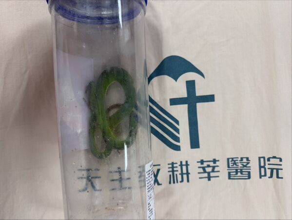 ▲▼老翁遭蛇咬後將蛇打死，就醫時一併帶來。（圖／新店耕莘提供）