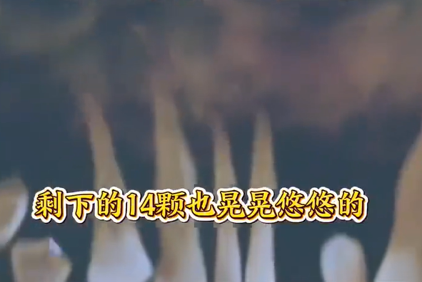 ▲▼44歲陸男已拔14顆牙。（圖／翻攝自微博）