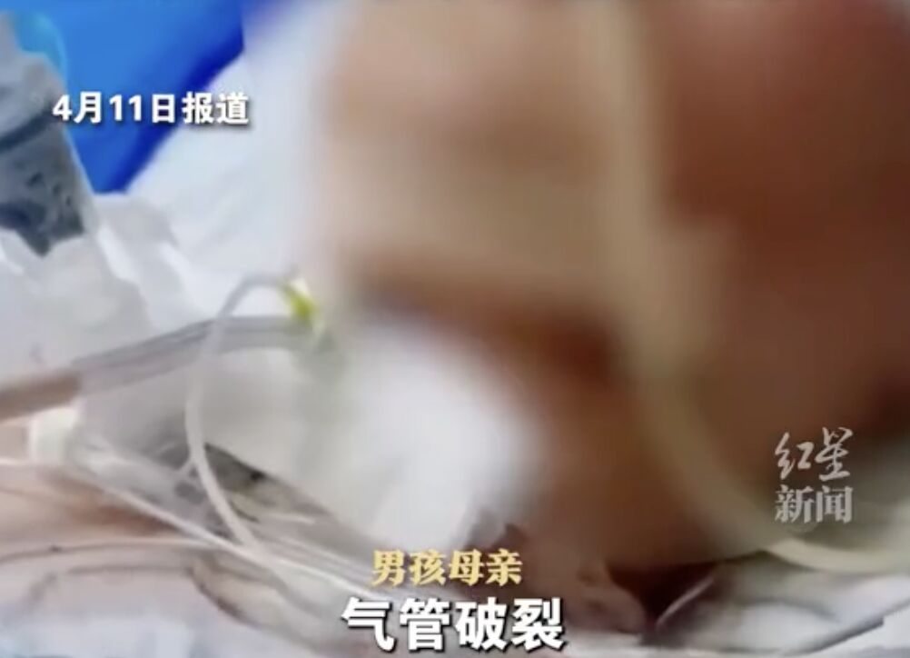 ▲少年氣管、食道皆破裂，仍有生命危險。（圖／翻攝極目新聞）