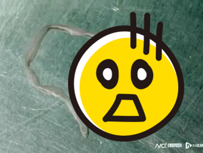 61歲女腦中抓出8cm活蟲！　她坦言：十幾歲曾多次用生蛙腿塞牙洞