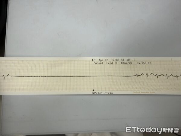 ▲▼「他會突然死掉！」急診醫想移床被攔　看監視器嚇瘋：心跳按暫停。（圖／粉專「急診碎碎念」授權提供）